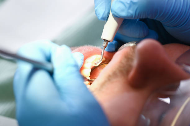 Best Pediatric Emergency Dentist in Chico, WA