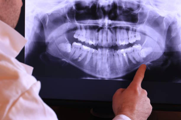 Best Emergency TMJ Treatment in Chico, WA