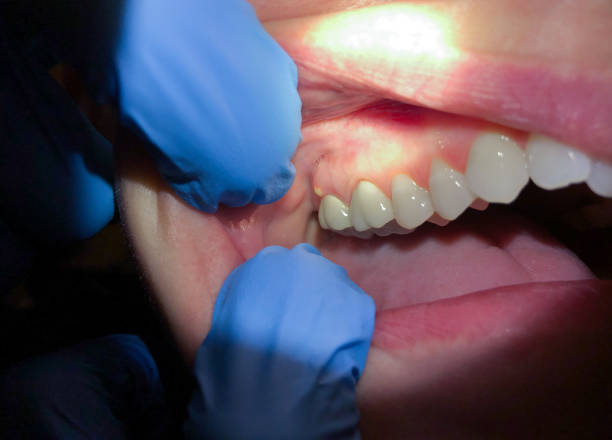 Best Cosmetic Emergency Dentistry in Chico, WA